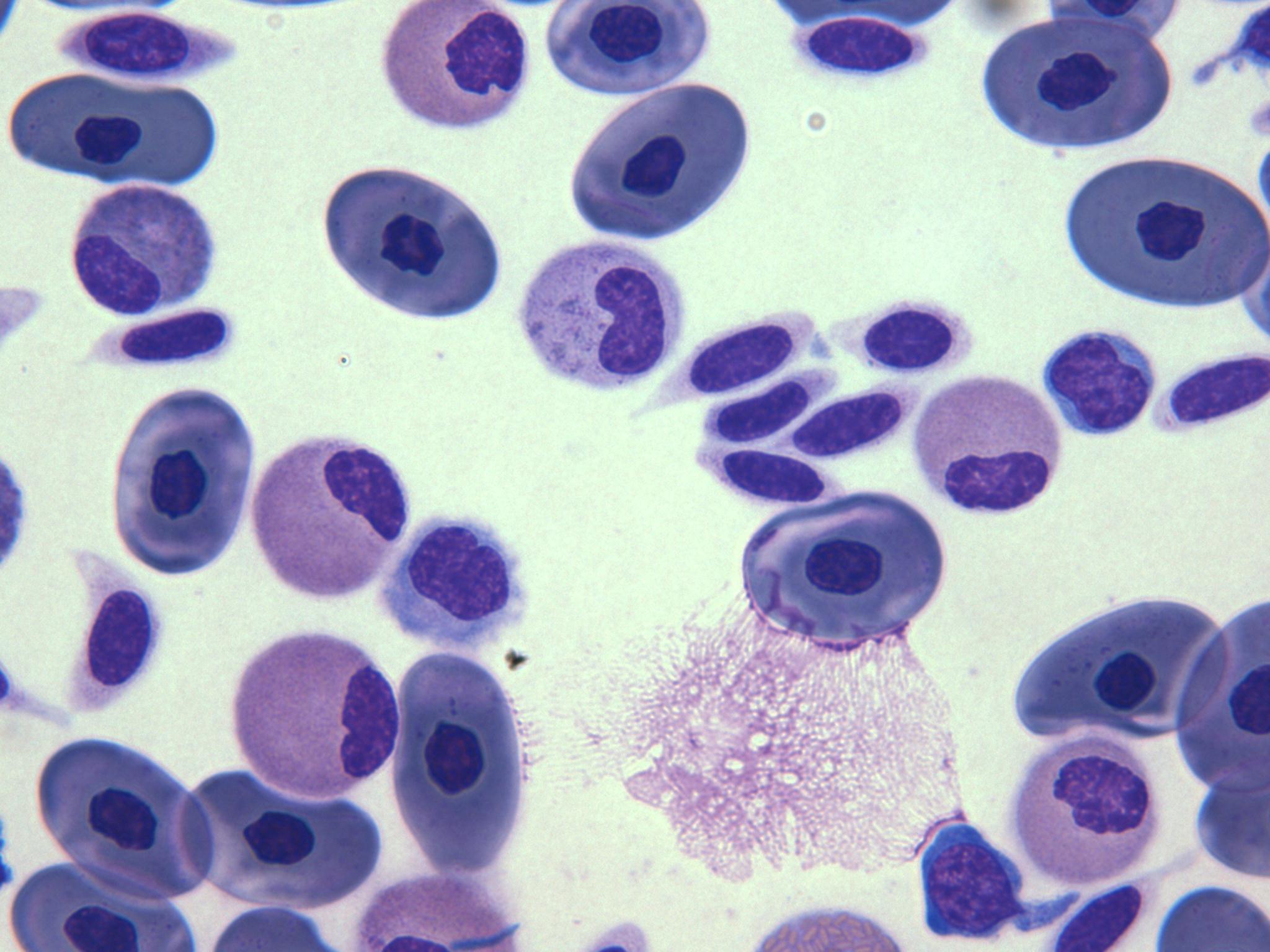 WS blood cells 2 Deep Sea News