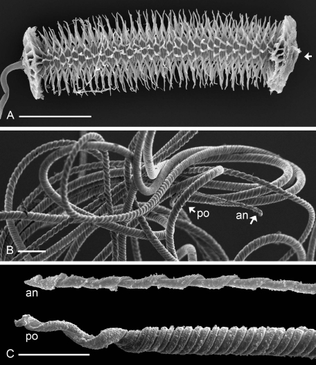 From Matzke-Karasz et al. 2009. Reproduction with giant sperm in the ostracode Eucypris virens (Cyprididae). (A) The distal section of the vas deferens is transformed into the chitinous skeleton of a sperm pump, or Zenker organ, pumping the giant sperm through the vas deferens into the voluminous, external penis. Arrowhead showing direction of sperm movement through the tube. (B) The filamentous, coiled sperm cells sport thin anterior (an) and thick posterior (po) parts. (C) Anterior (an) and posterior (po) tips of E. virens sperm cells. Scale bars 100 μm for A, 10 μm for B, C.